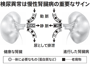 慢性腎臓病の定義